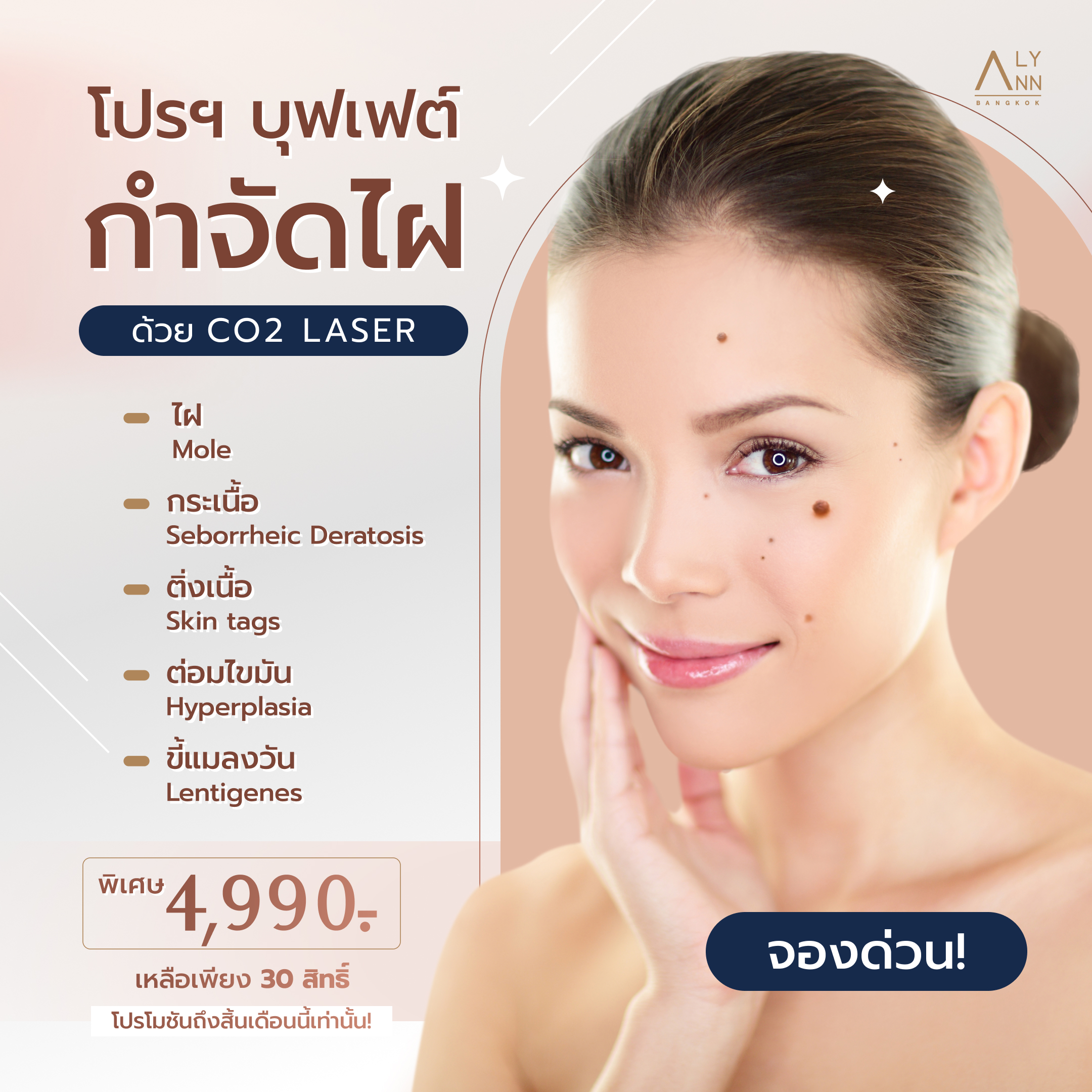 โปรโมชั่นบุฟเฟต์กำจัดไฝ CO2 LASER