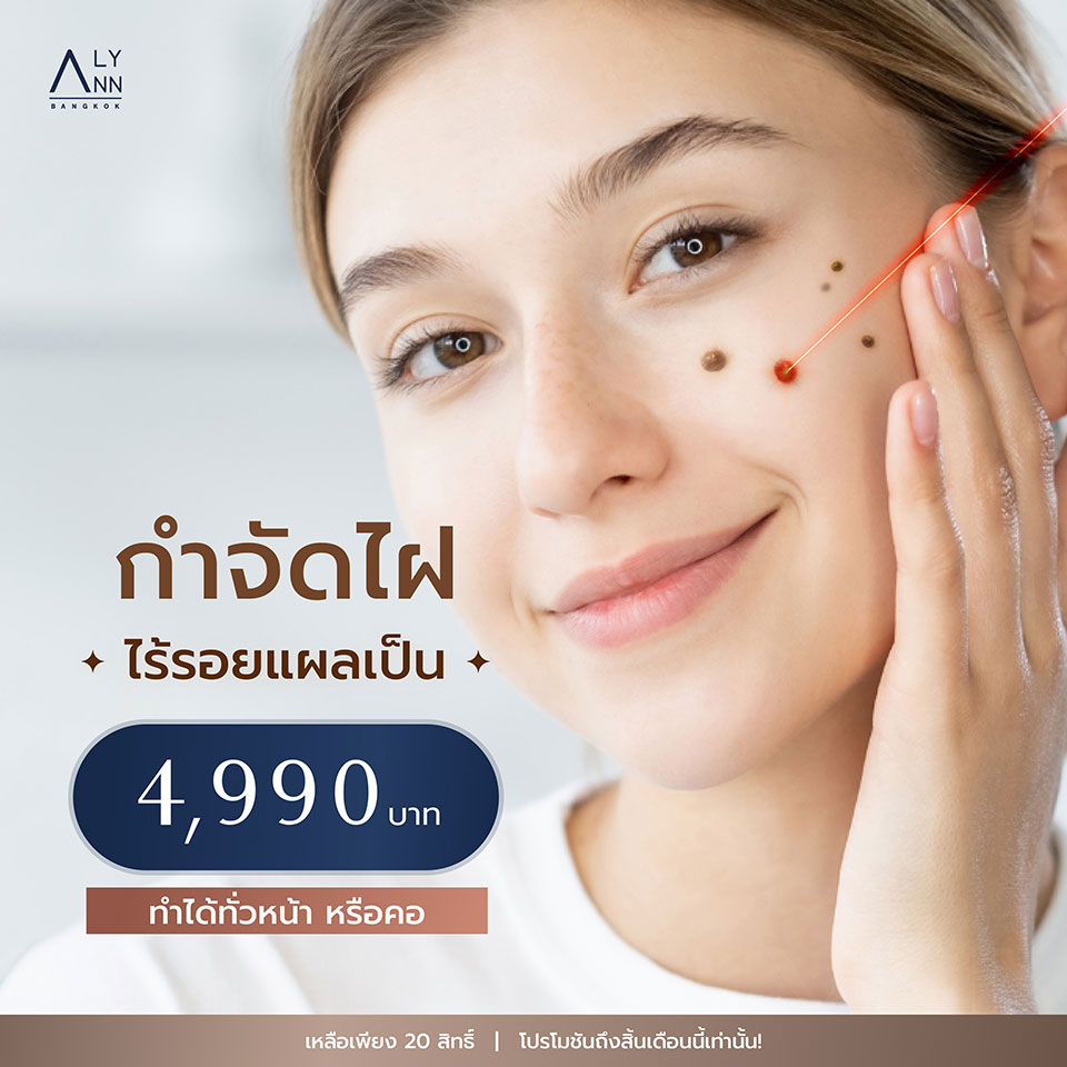 ทำไม? ต้องเลเซอร์ Co2 ที่ CLINIC ALYNN